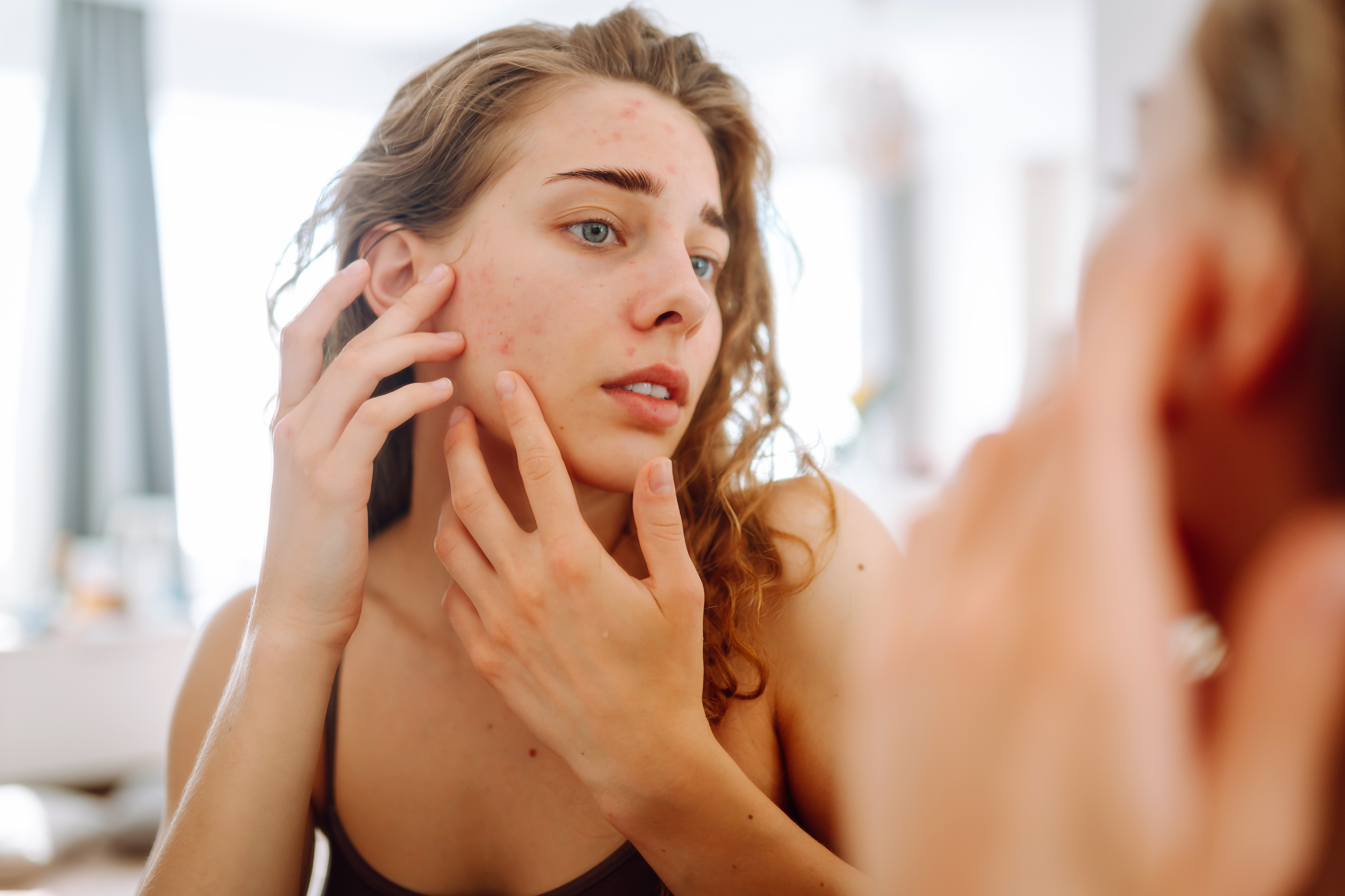 Young woman examining acne on her cheek in the mirror